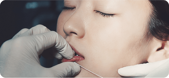 안전 시술 장면