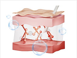 벨로테로 리바이브 주입