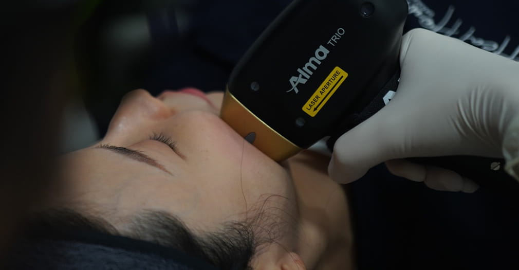 티타늄 타이트닝