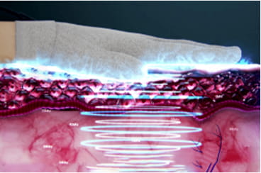 공명 에너지 전달