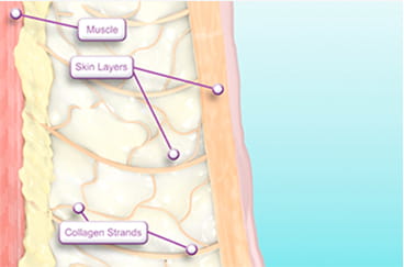 공명 에너지 전달