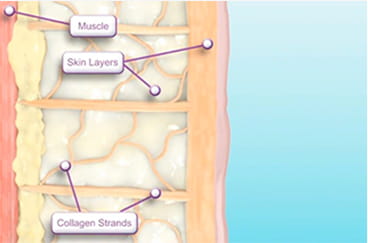 진피 컨디션 정돈