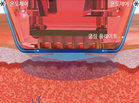 첨단 쿨링 시스템