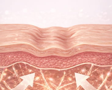 마이크로니들 접촉