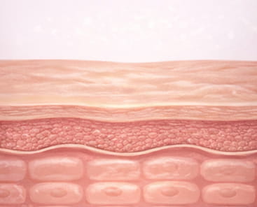 고주파 에너지 전달