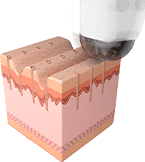 마이크로-젯 형성 및 분사