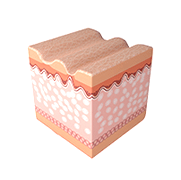 섬유아세포 자극