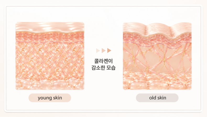 30대에 접어들면서 어린 피부와는 달리 콜라겐이 헌저하게 감소한 모습 / 힐하우스피부과 강남