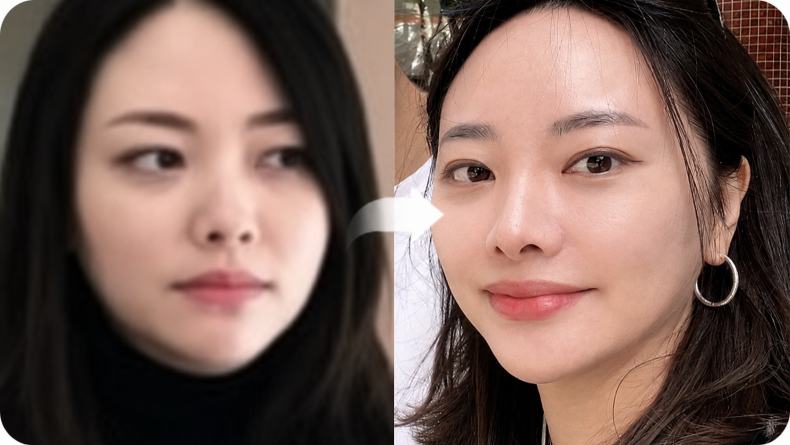 힐하우스피부과 더엘주사 시술 전후.png